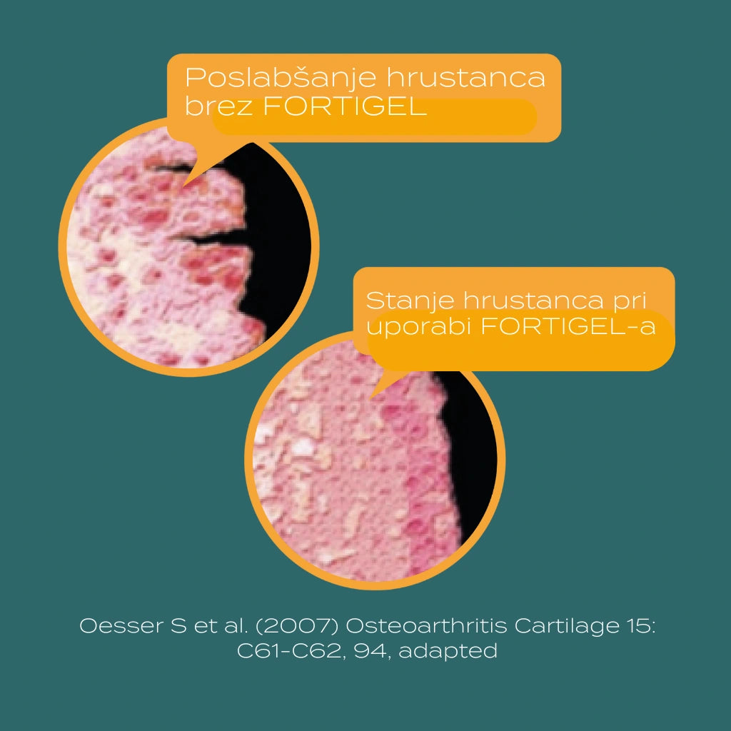 fortigel kolagen